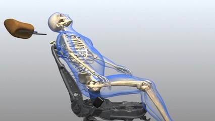 Vehicle accident reconstruction — litigation animation