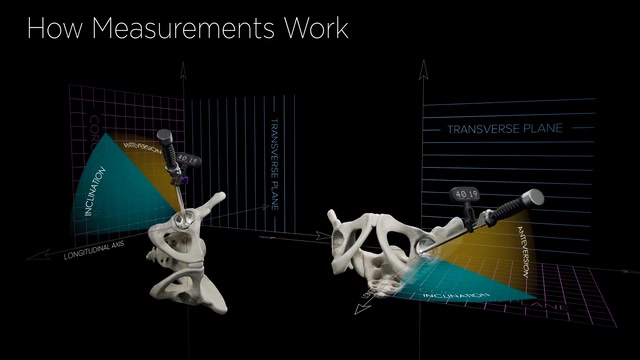 Surgical Navigation System -- Medical Devices animation
